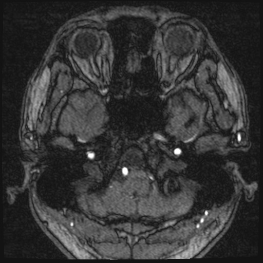 Click on the Serie image to view the images of VILLANUEVA, WILLIAM A.